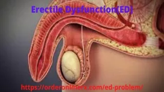 Erectile Dysfunction (ED)