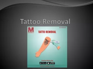 tatoo removal ppt
