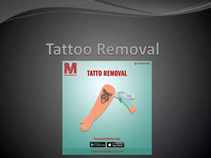 tattoo removal