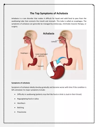 the top symptoms of achalasia