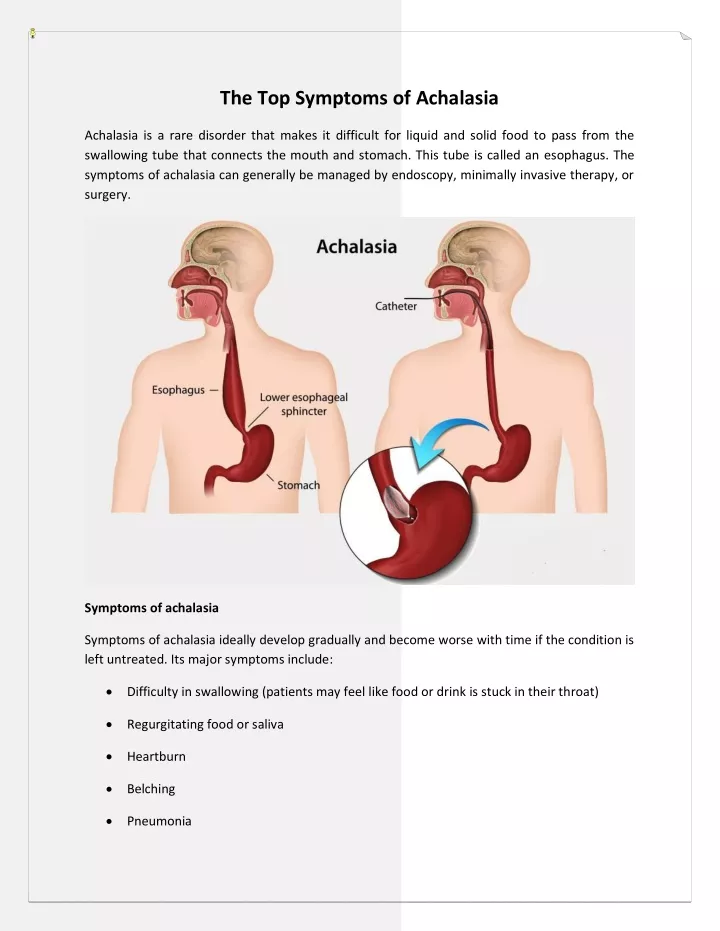 the top symptoms of achalasia