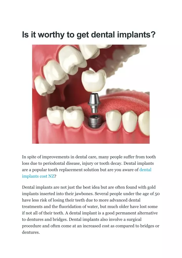 is it worthy to get dental implants
