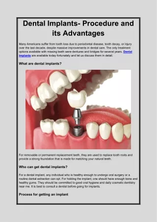 Dental Implants- Procedure and its Advantages