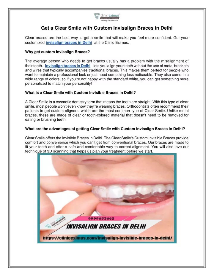 get a clear smile with custom invisalign braces