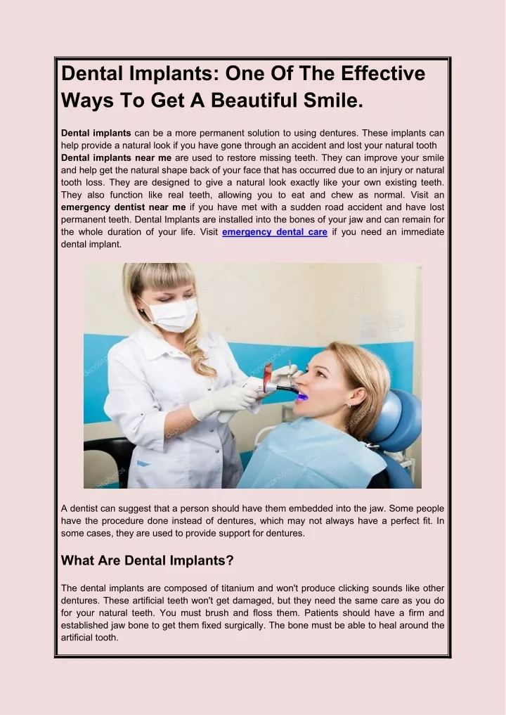 dental implants one of the effective ways