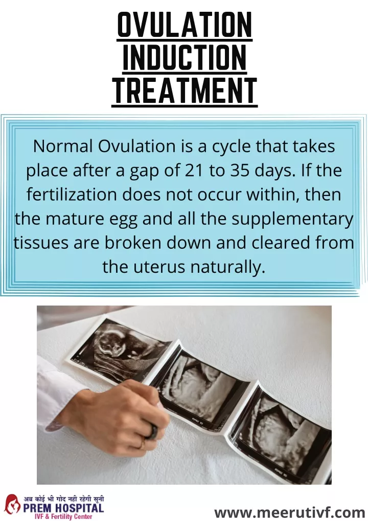 ovulation induction treatment