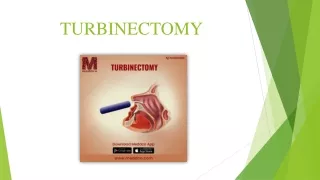 Turbinectomy - Meddco
