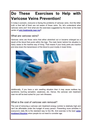 Do These  Exercises to Help with Varicose Veins Prevention!