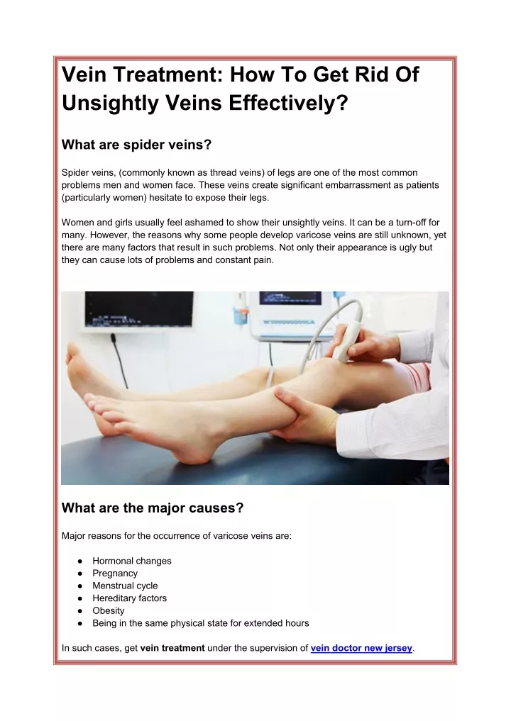 vein treatment how to get rid of unsightly veins