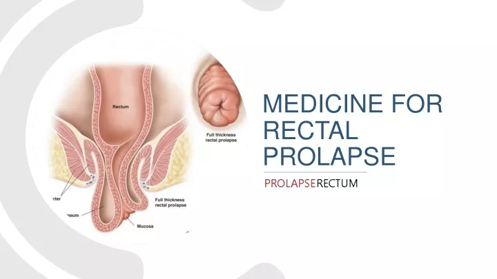 medicine for rectal prolapse