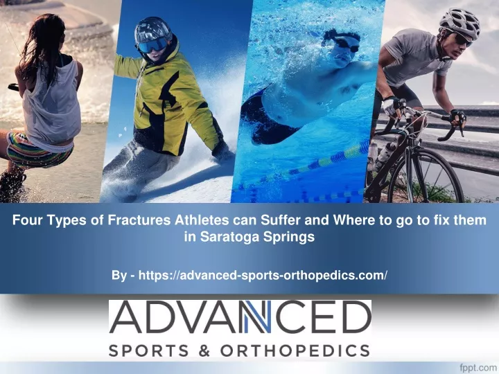 four types of fractures athletes can suffer and where to go to fix them in saratoga springs