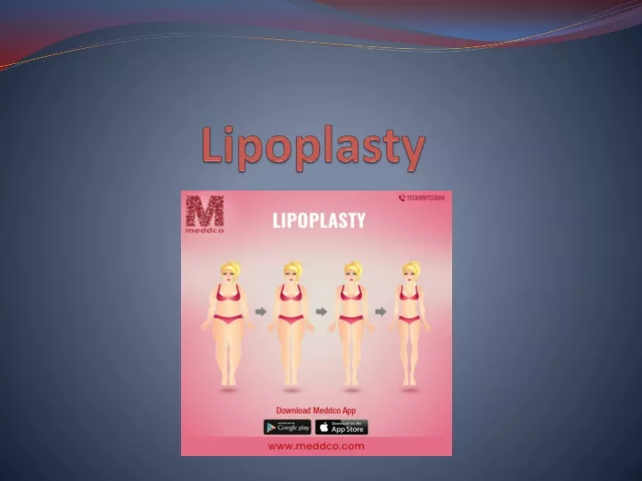 lipoplasty