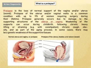 what is a prolapse