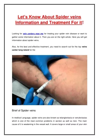 Let’s Know About Spider veins Information and Treatment For it!