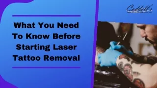 What You Need to Know Before Starting Laser Tattoo Removal