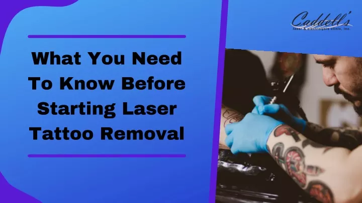 what you need to know before starting laser