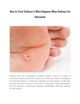 how to treat calluses what happens when calluses