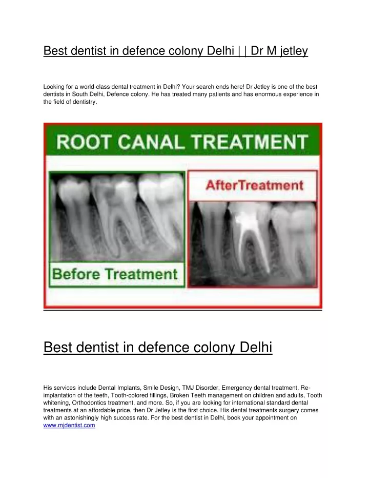 best dentist in defence colony delhi dr m jetley