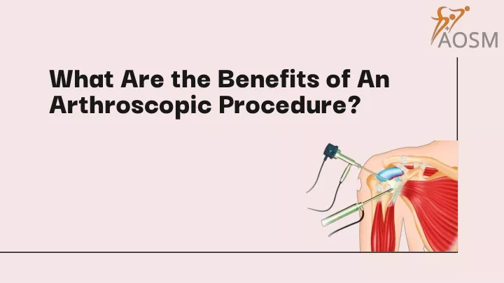 what are the benefits of an arthroscopic procedure