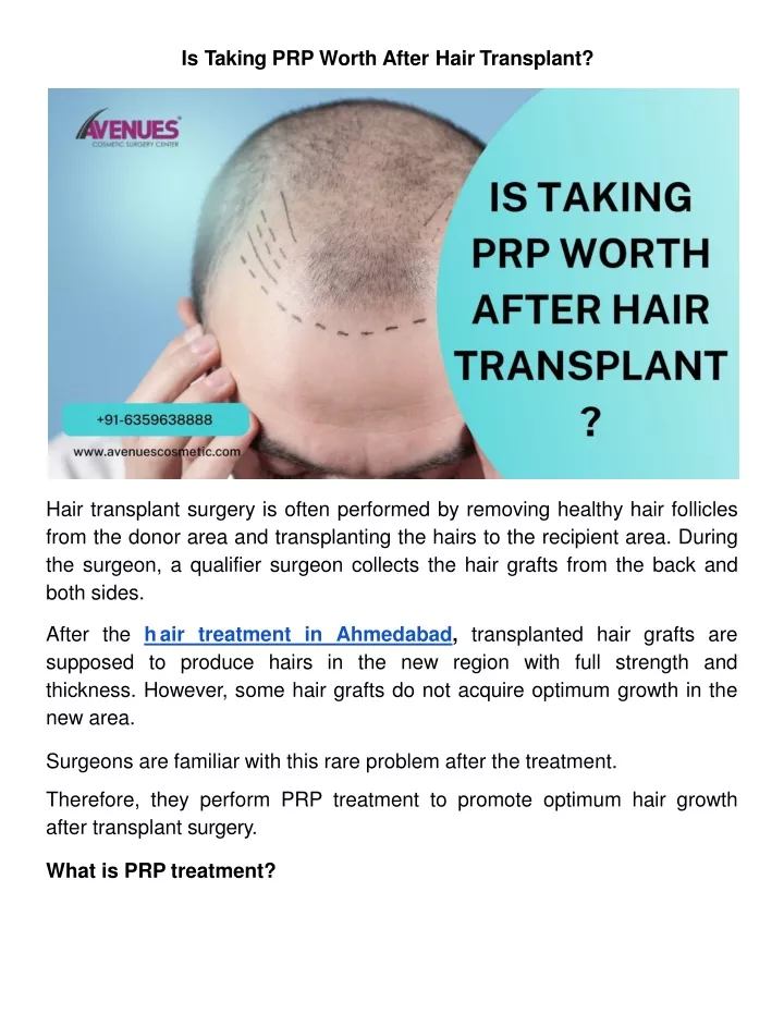 is taking prp worth after hair transplant