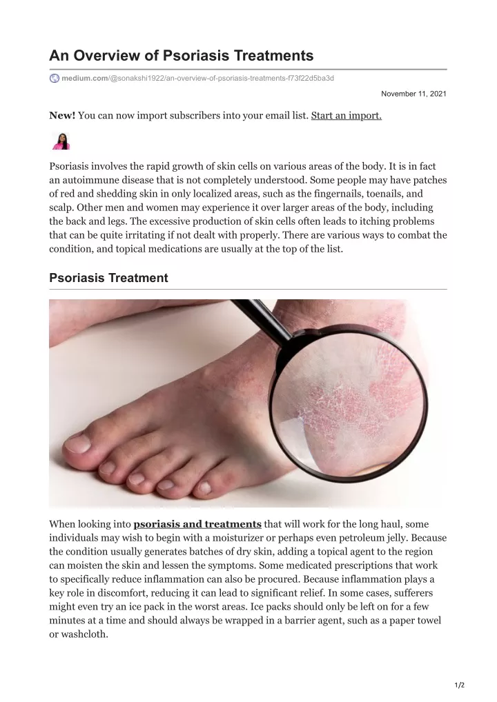 an overview of psoriasis treatments