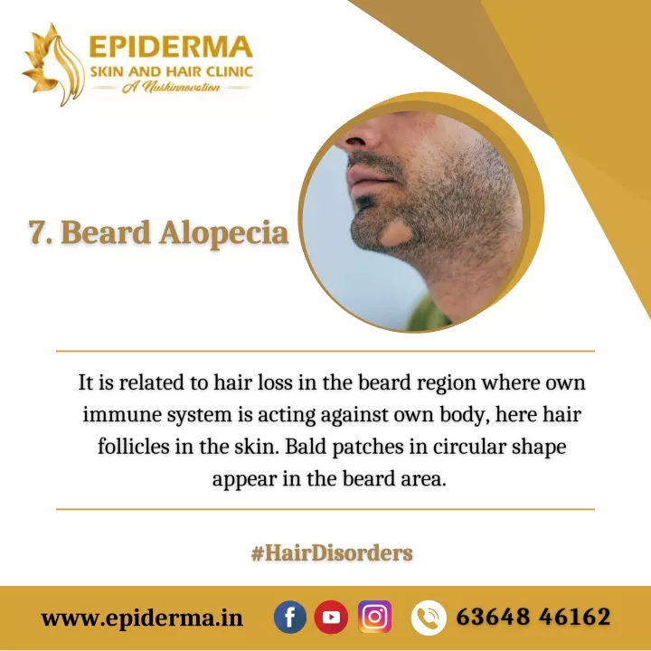 Ppt Beard Alopecia Best Hair Loss Treatment In Bangalore Epiderma Clinic Powerpoint 3898