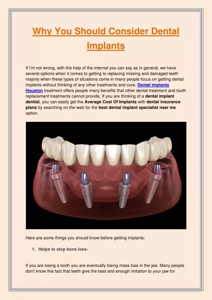 why you should consider dental implants