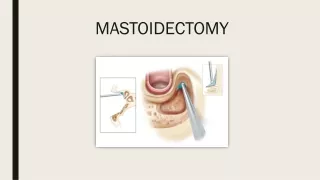 Mastoidectomy - Meddco