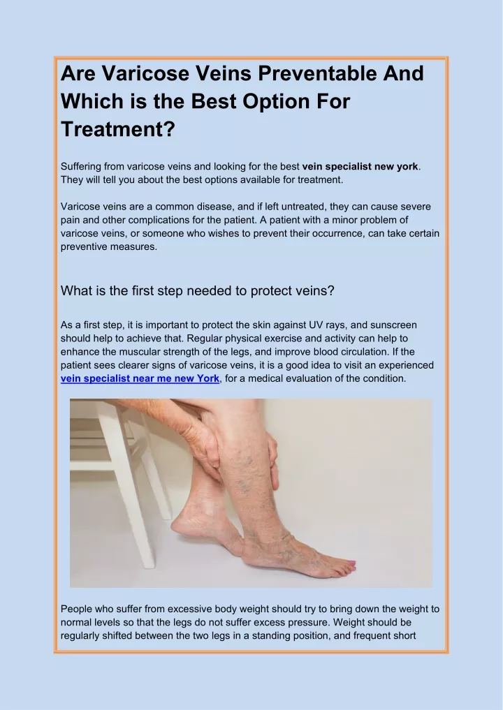 are varicose veins preventable and which