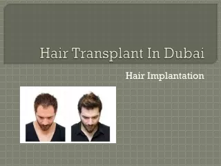 Hair Transplant In Dubai