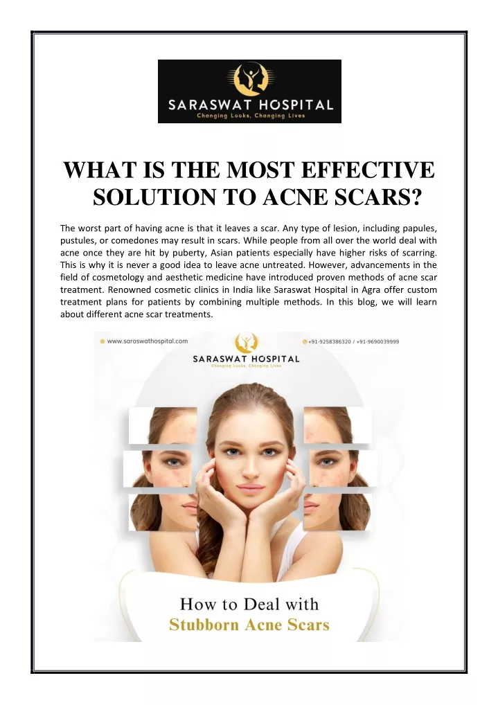 what is the most effective solution to acne scars