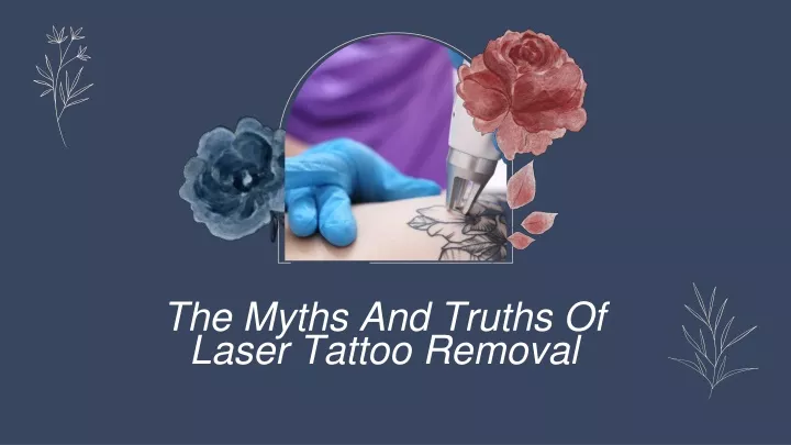 the myths and truths of laser tattoo removal