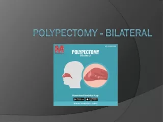 Polypectomy - bilateral