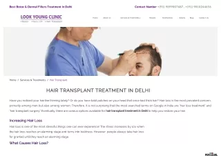 Hair Transplant In Delhi | Look Young Clinic