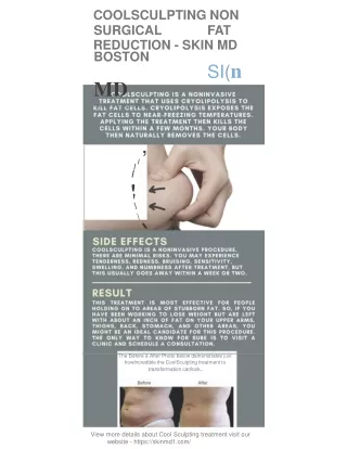 CoolSculpting: Non Surgical Fat Reduction | Skin MD Boston