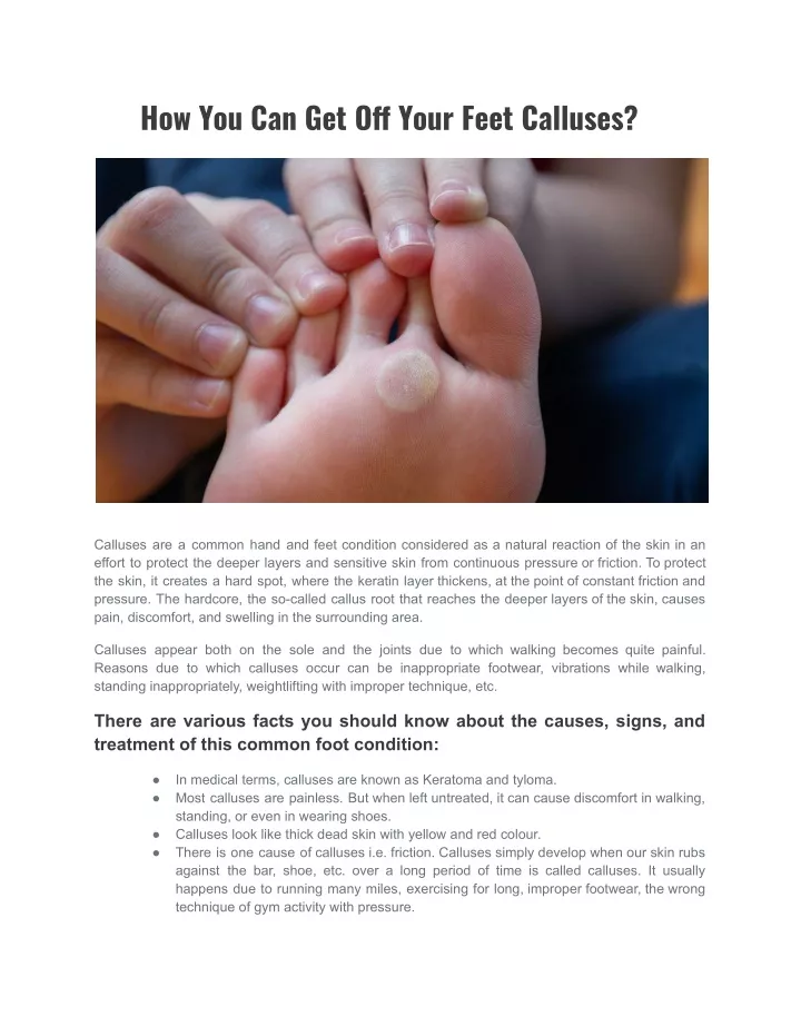 how you can get o your feet calluses