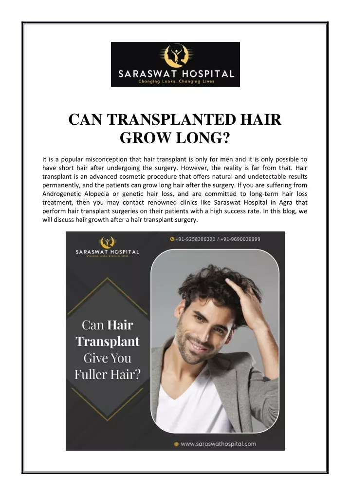 can transplanted hair grow long