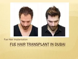 Fue Hair Transplant In Dubai
