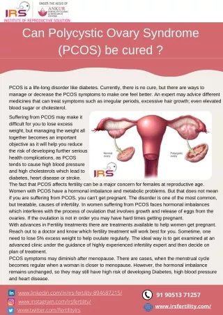 How Long Does It Take for PCOS To Go Away?