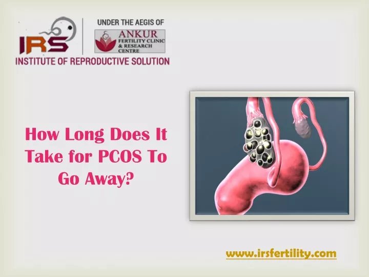 how long does it take for pcos to go away