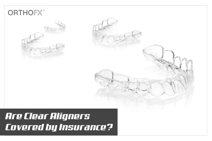 are clear aligners covered by insurance