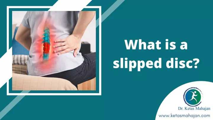 what is a slipped disc