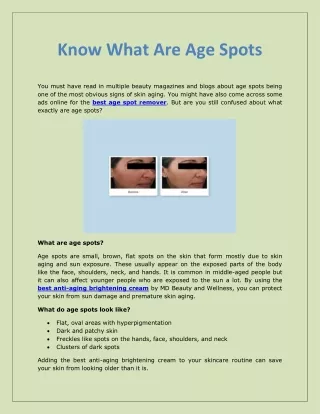 Know What Are Age Spots