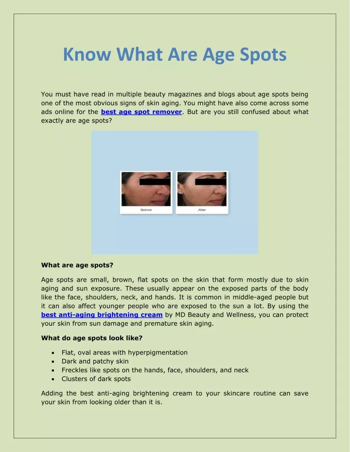 know what are age spots