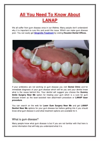 all you need to know about lanap