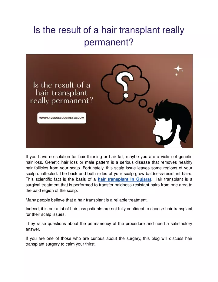 is the result of a hair transplant really permanent