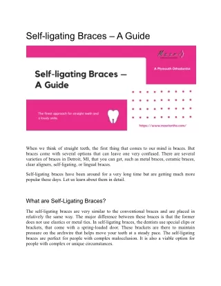 Self-Ligating Braces — A Guide