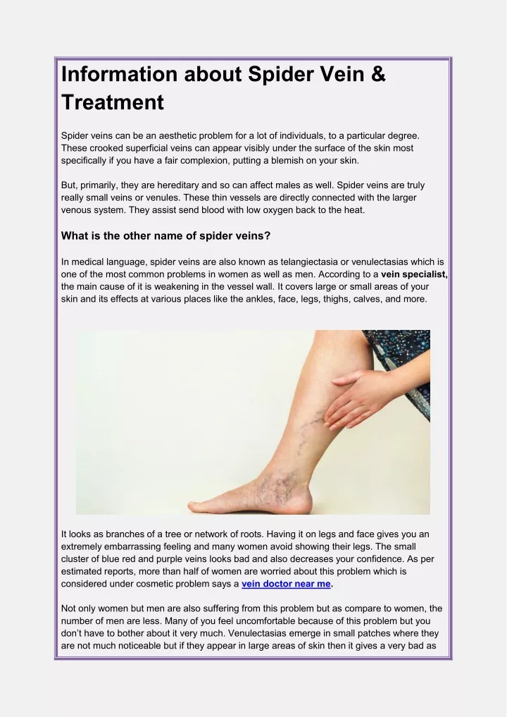 information about spider vein treatment