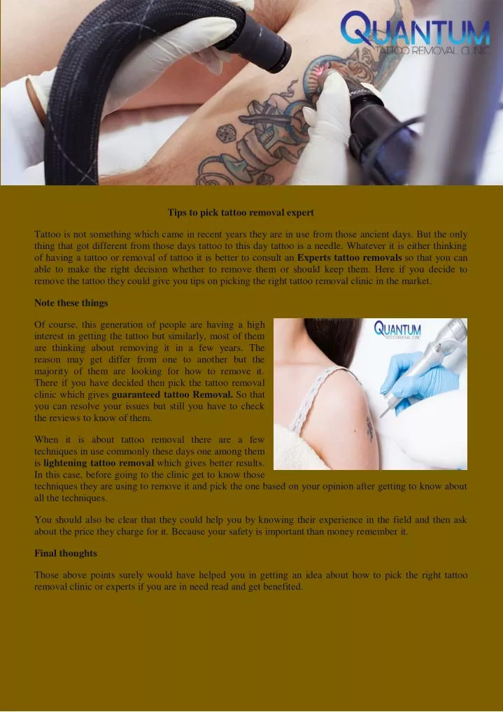 tips to pick tattoo removal expert