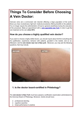 Things To Consider Before Choosing A Vein Doctor_
